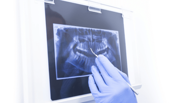 Dental Clinics In Serangoon